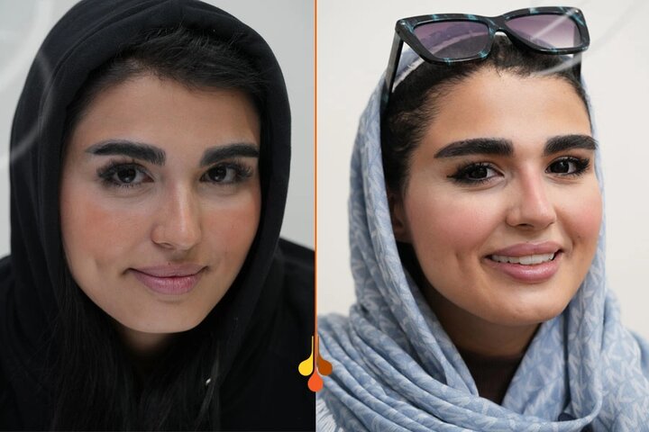 سیخ شدن ابرو بعد از کاشت — سیخ شدن ابرو بعد از کاشت؛ دلایل، زمان اصلاح و مراقبت‌های درست